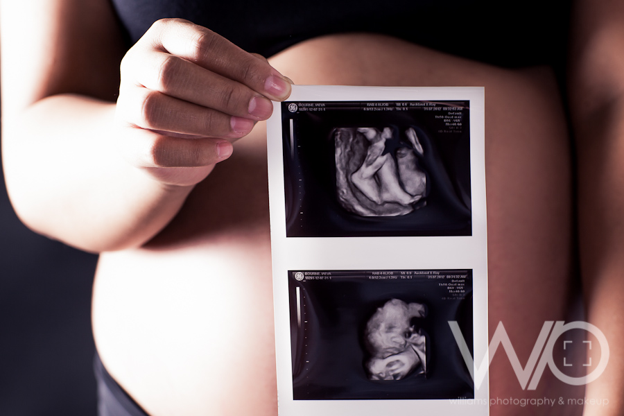 Auckland Maternity Photos
